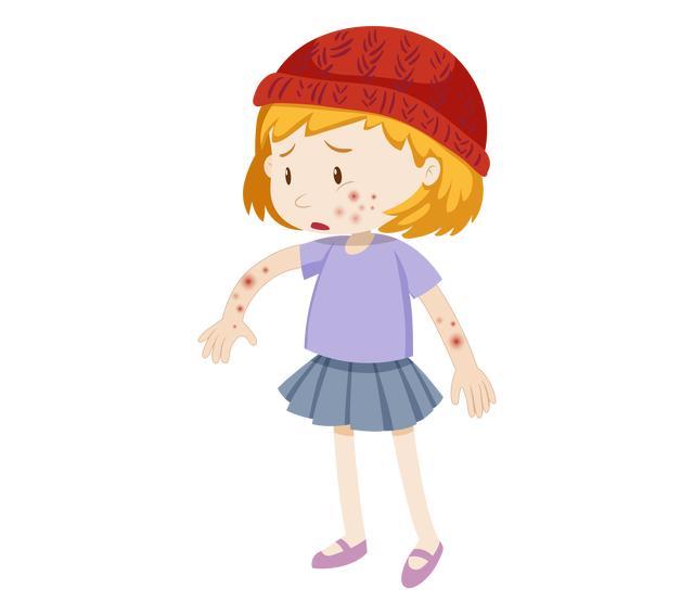 酷客健康全方位播报湿疹中医治疗相关话题全面解读湿疹中医治疗新闻